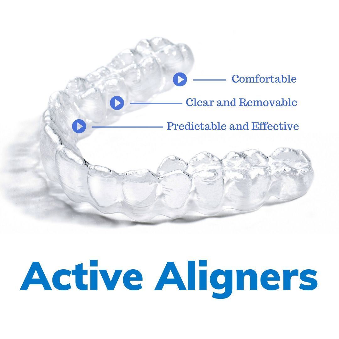 Active Aligners are comfortable, clear, removable, predictable and effective